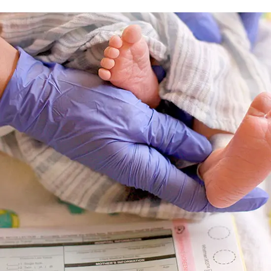 galactosemia newborn screening test